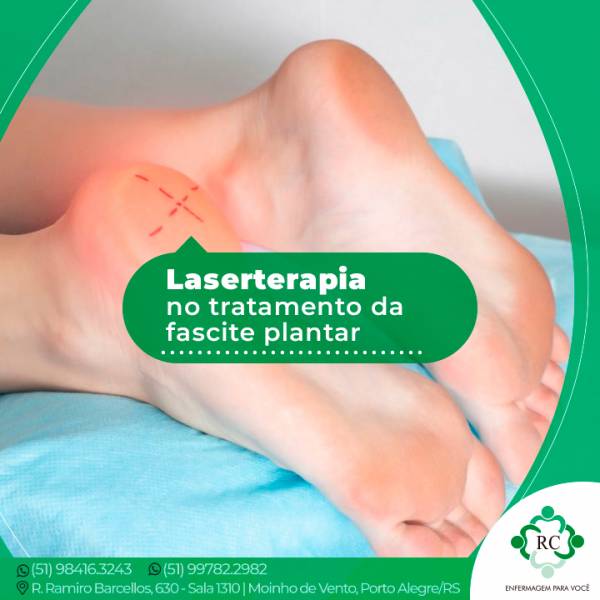 Laserterapia no tratamento da fascite plantar